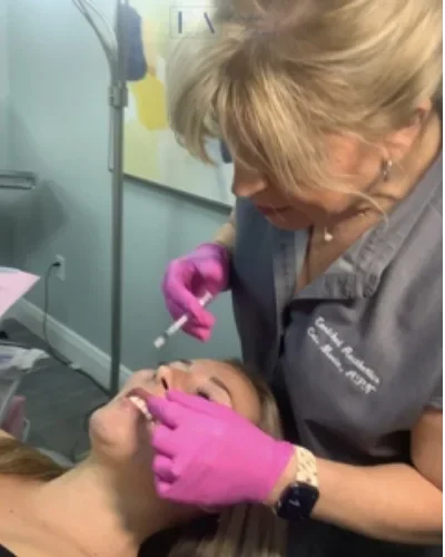 Lip Filler Procedure In Action