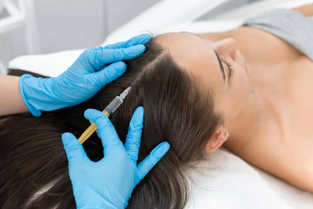 Platelet-Rich Plasma Hair Restoration: What You Need to Know