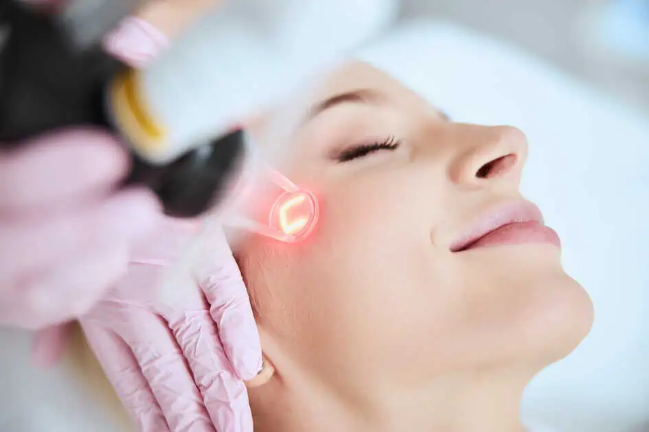 Tetra CO2 laser Treatment by Enriched Aesthetics in Morristown, NJ