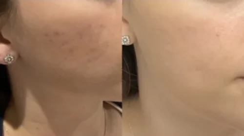 The Brides Journey to her Magical Wedding Day