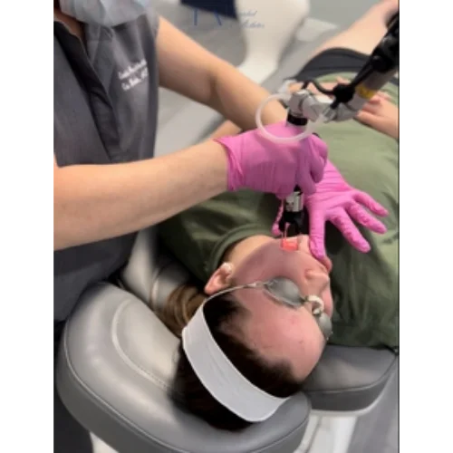 CoolPeel Skin Resurfacing Laser Treatment