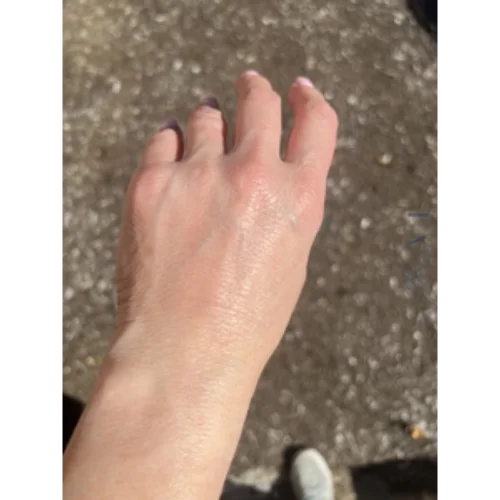 CoolPeel Hand Treatment